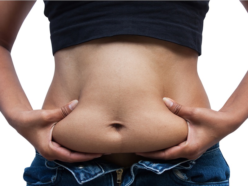 ابدومینوپلاستی