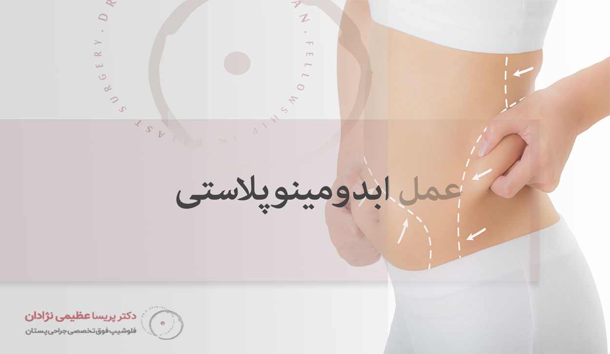 جراحی-ابدومینوپلاستی