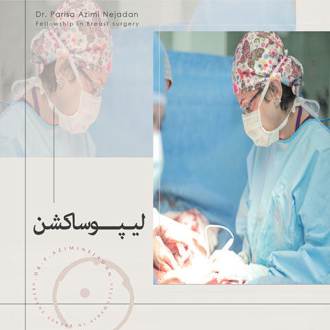 جراحی-لیپوساکشن