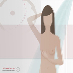 معاینه-پستان-داخل-حمام