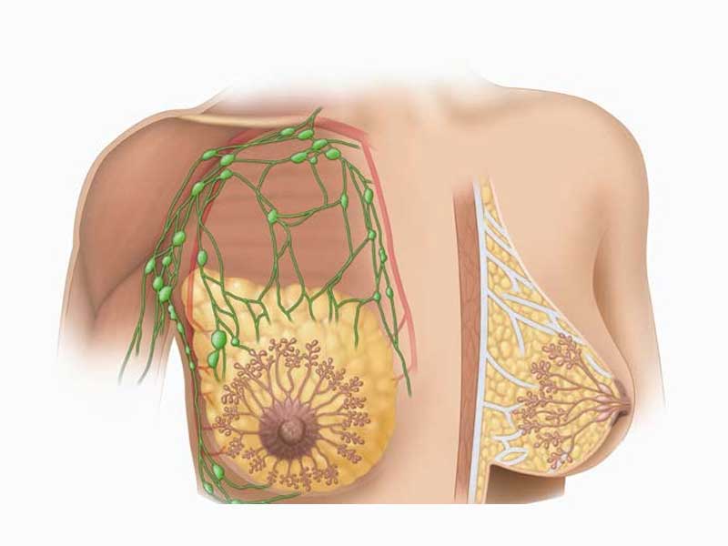 التهاب پستان