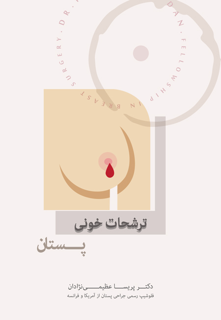 ترشحات خونی پستان