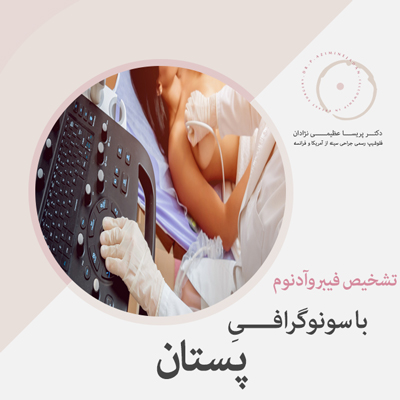 تشخیص فیبروآدنوم