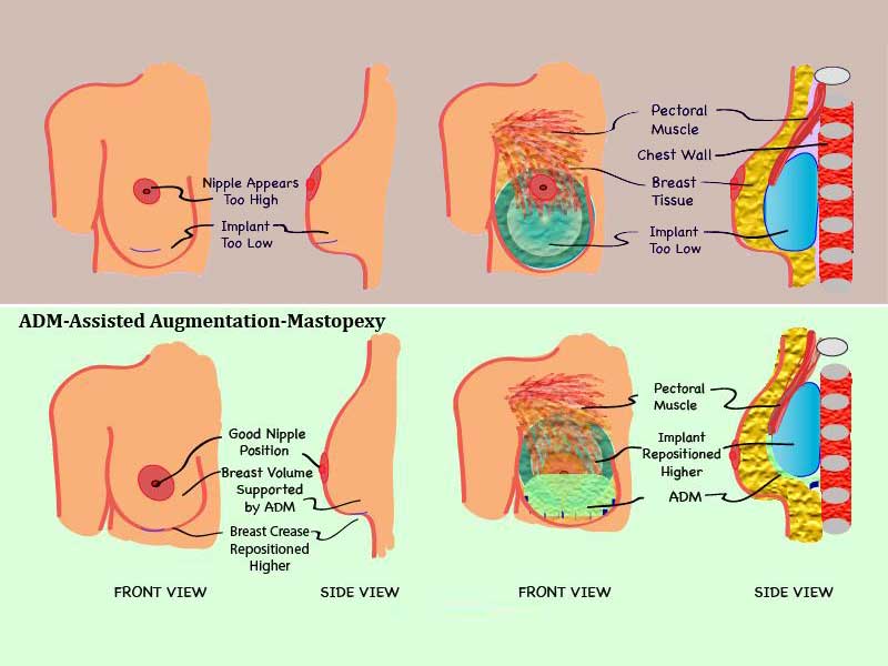 جراحی-ترمیمی-سینه