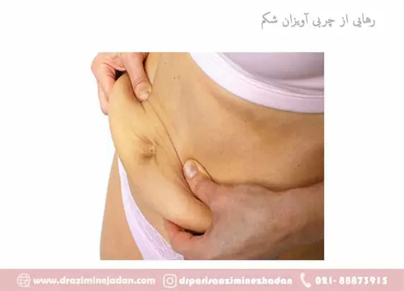 رهایی از چربی شکم
