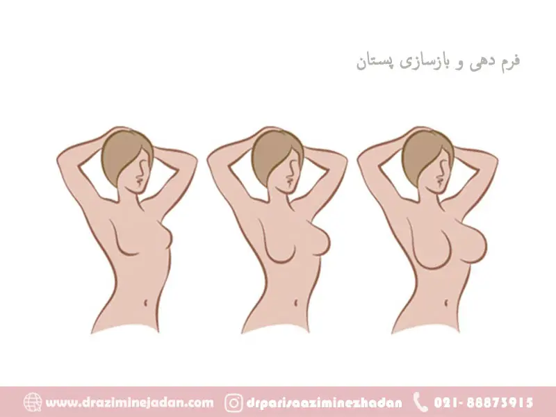 فرم دهی و بازسازی پستان