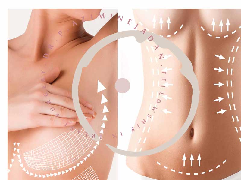 جراحی-زیبایی-بدن