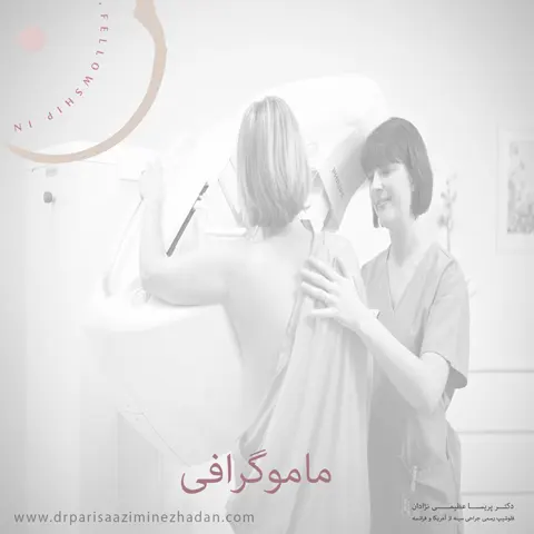 ماموگرافی