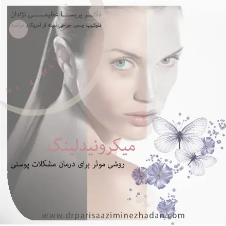 میکرونیدلینگ