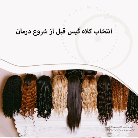 انتخاب کلاه گیس قبل از شروع درمان