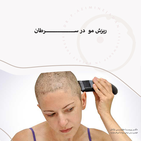 ریزش مو در افراد مبتلا به سرطان