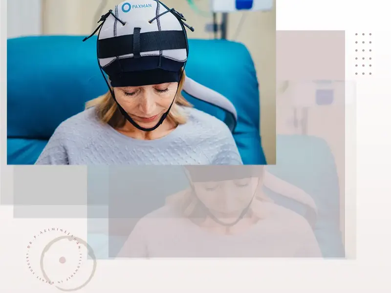 کاهش ریزش مو با کلاه های خنک کننده