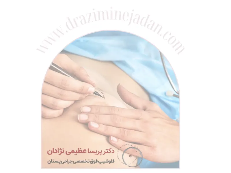 جراحی لیفت ماموپلاستی افزایشی