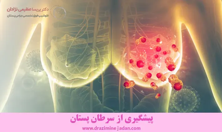 پیشگیری از سرطان سینه