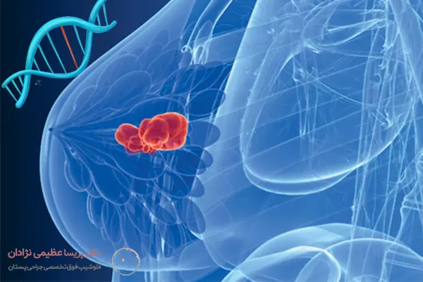 سرطان سینه و ژنتیک سرطان سینه و ژنتیک