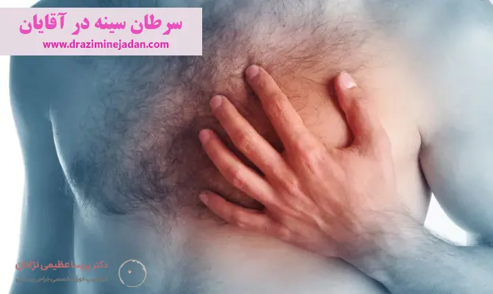 سرطان سینه در آقایان سرطان سینه در آقایان