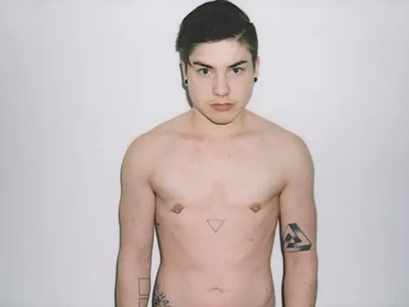 مراقبت‌های پس از جراحی تخلیه پستان در افراد ترنس