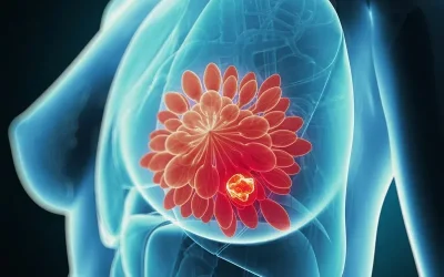 سرطان متاستاتیک سینه قابل درمان است؟