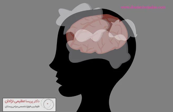علت مه مغزی چیست؟