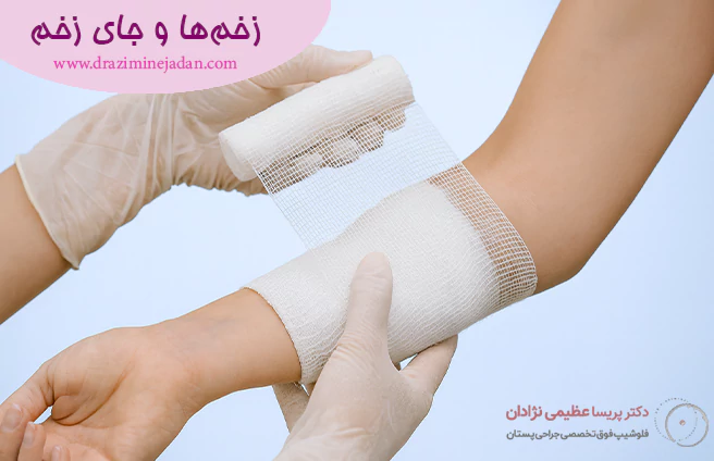 نگهداری از زخم‌ ها
